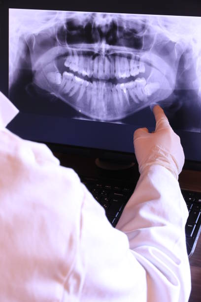Best Emergency Tooth Extraction in Vadnais Heights, MN